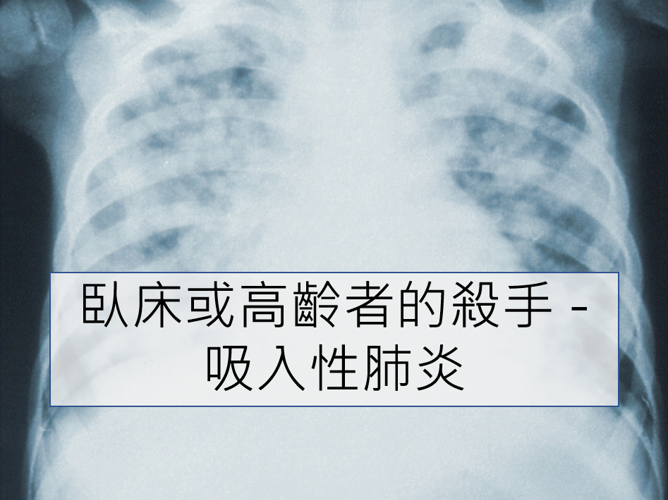 【醫療知識】臥床或高齡者的殺手 – 吸入性肺炎